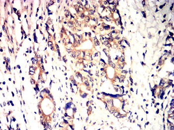 FOXO3 Antibody