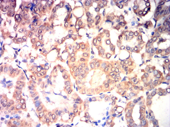 SUMO1 Antibody
