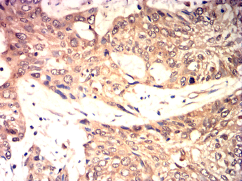 SUMO1 Antibody