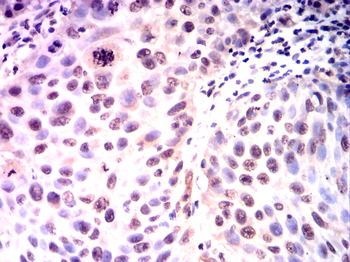 SUMO1 Antibody