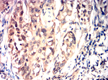 SUMO1 Antibody