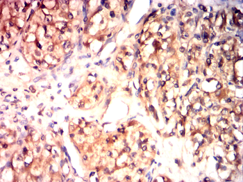 SUMO1 Antibody