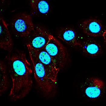 RELA Antibody