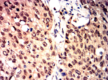 RELA Antibody