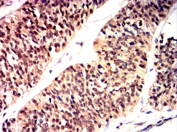 RELA Antibody