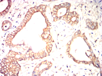 KRT19 Antibody