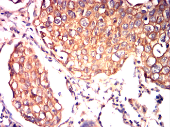 KRT19 Antibody