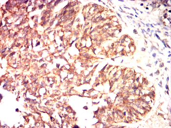 KRT19 Antibody