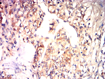 KRT19 Antibody