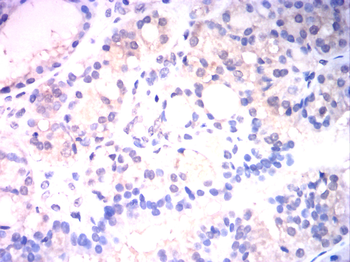 SOX9 Antibody