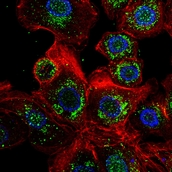TBK1 Antibody