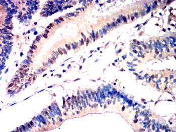 TBK1 Antibody