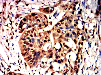 TBK1 Antibody