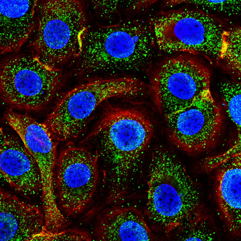 CLDN2 Antibody