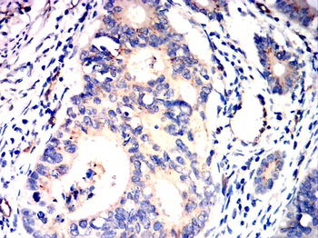 CLDN2 Antibody