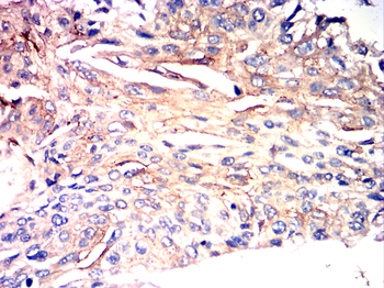CLDN2 Antibody