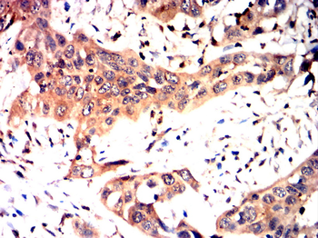 CLDN2 Antibody