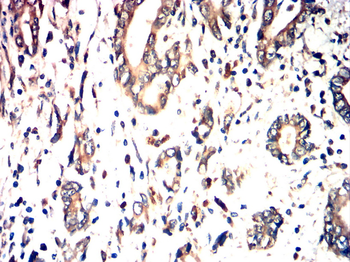 IKBKB Antibody