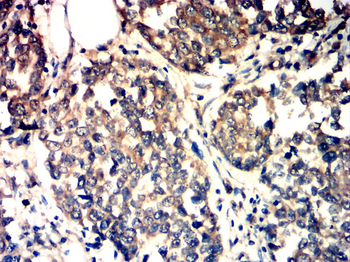 NTRK2 Antibody