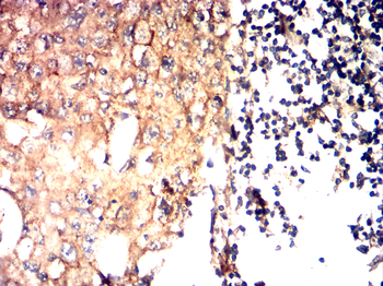 NTRK2 Antibody