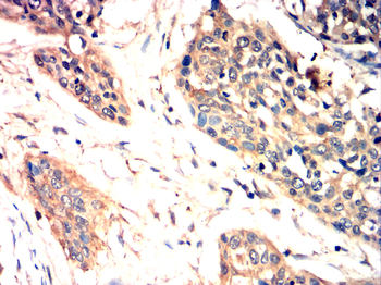 NTRK2 Antibody