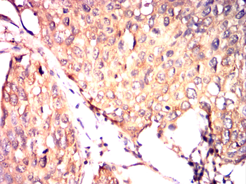 NTRK2 Antibody