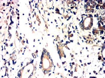 NTRK2 Antibody