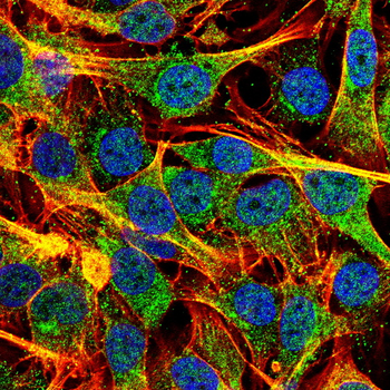 FOXO1 Antibody