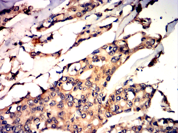 FOXO1 Antibody