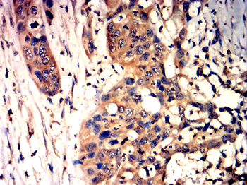 FOXO1 Antibody