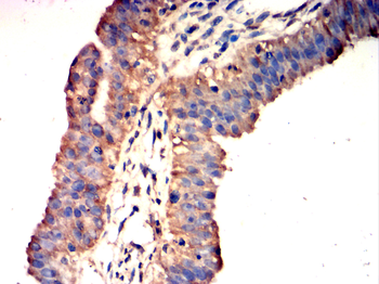 FOXO1 Antibody