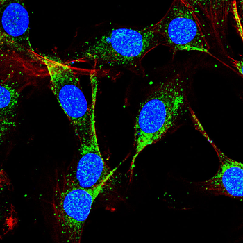 FAS Antibody