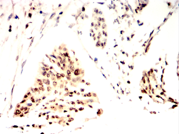 STAT6 Antibody