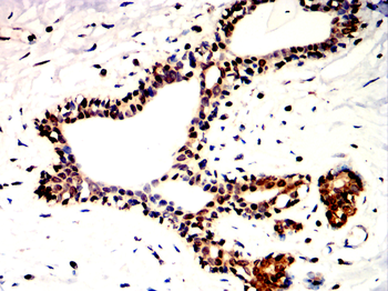 STAT6 Antibody