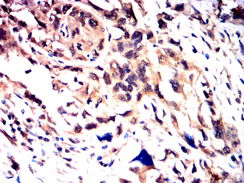 STAT6 Antibody