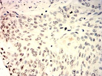 STAT6 Antibody