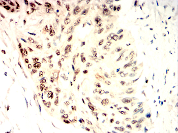 STAT6 Antibody