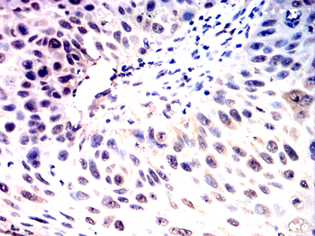 STAT6 Antibody