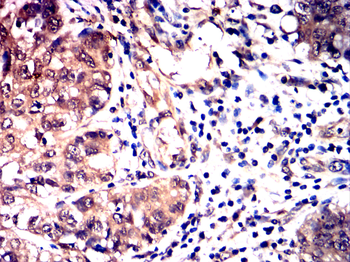 STAT6 Antibody