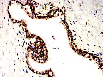 STAT6 Antibody