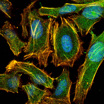 AFP Antibody