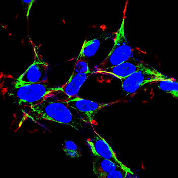 KRT18 Antibody
