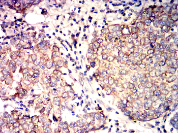 KRT18 Antibody