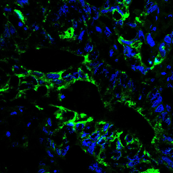 KRT18 Antibody