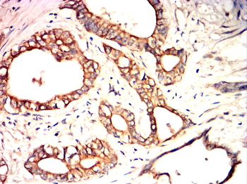 KRT18 Antibody