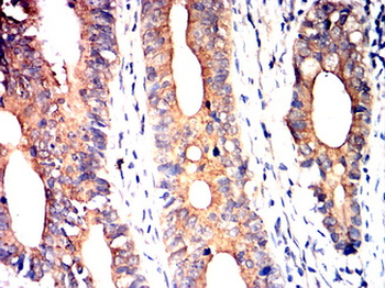 KRT18 Antibody