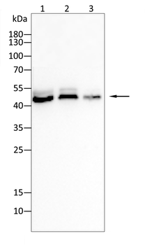 KRT18 Antibody