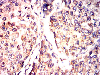 CCNB1 Antibody