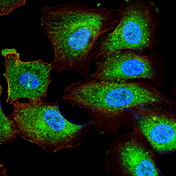 S100A8 Antibody