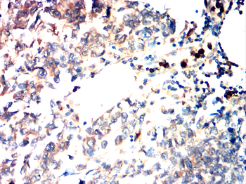 S100A8 Antibody